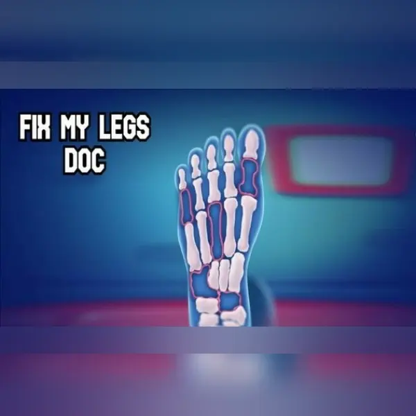 Fix My Legs Doc — Steam, Standard